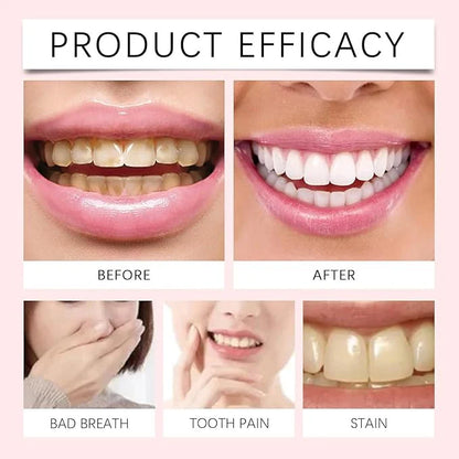 Oralhoe - Nicotinamide Dazzle White Toothpaste | أورالهوي - معجون أسنان مبيّض لامع بالنيكوتيناميد